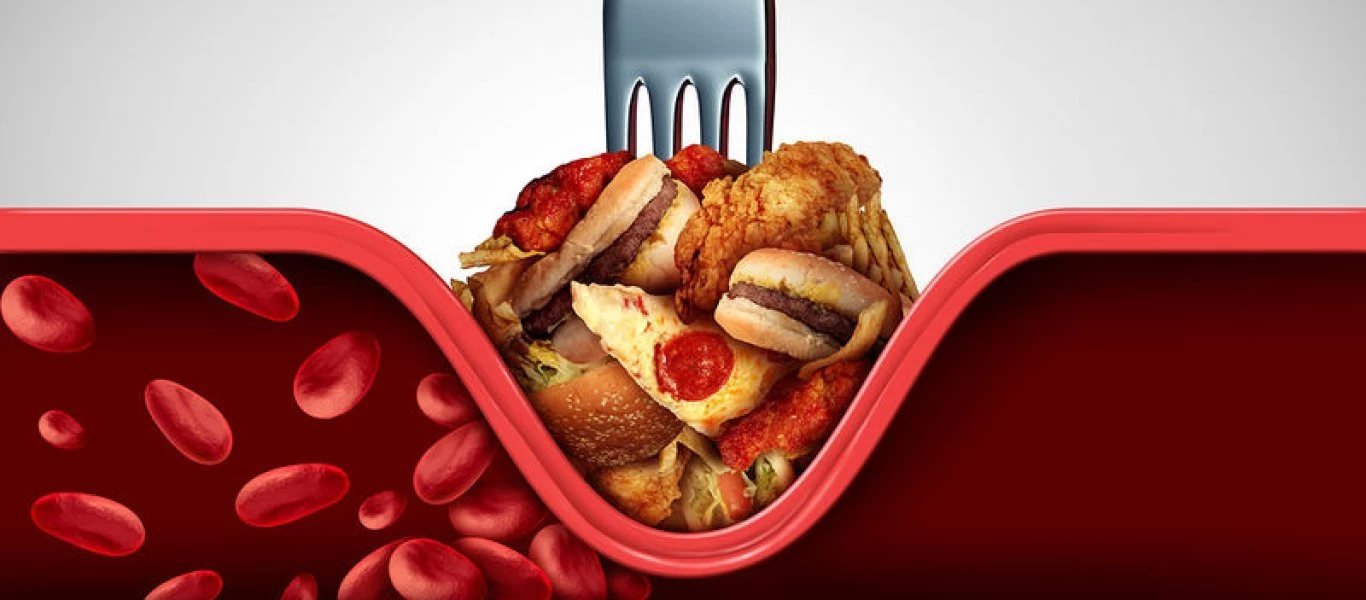 Τι να καταναλώσετε για να ρίξετε τη χοληστερίνη μετά το Χριστουγεννιάτικο τραπέζι